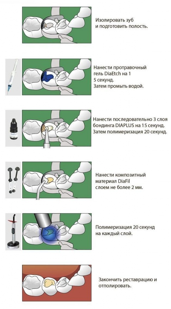 1_1.jpg 1_1.jpg