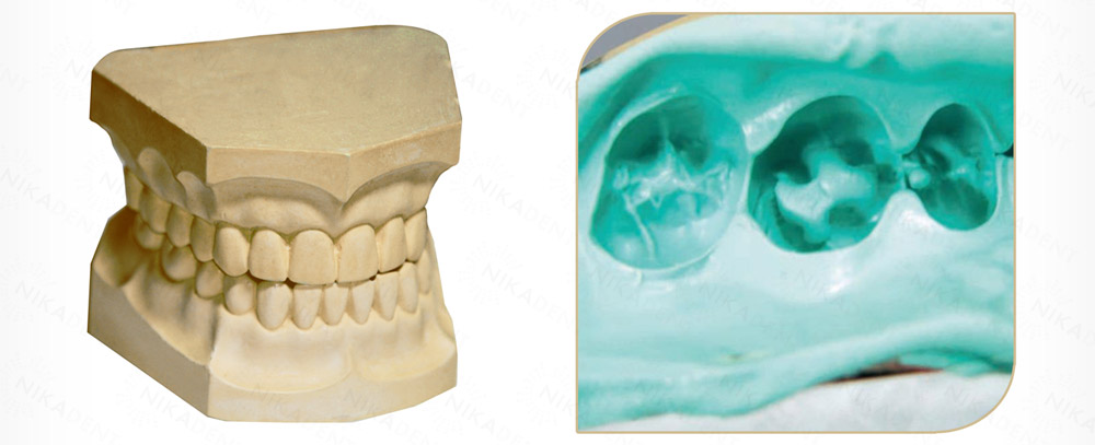 vonflex S Putty, А-силикон стоматологический для снятия базовых оттисков.